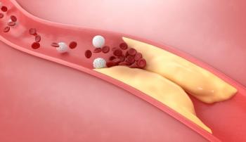 Koroner Anjiyografi ve Stent Takılması İşlemi